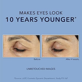 Foto 6 | Venta Internacional-Crema para Ojos Roc de 15 Ml