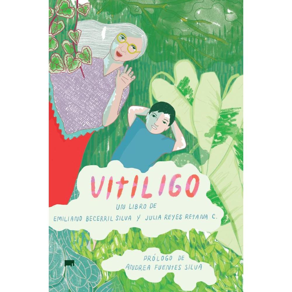 Vitiligo