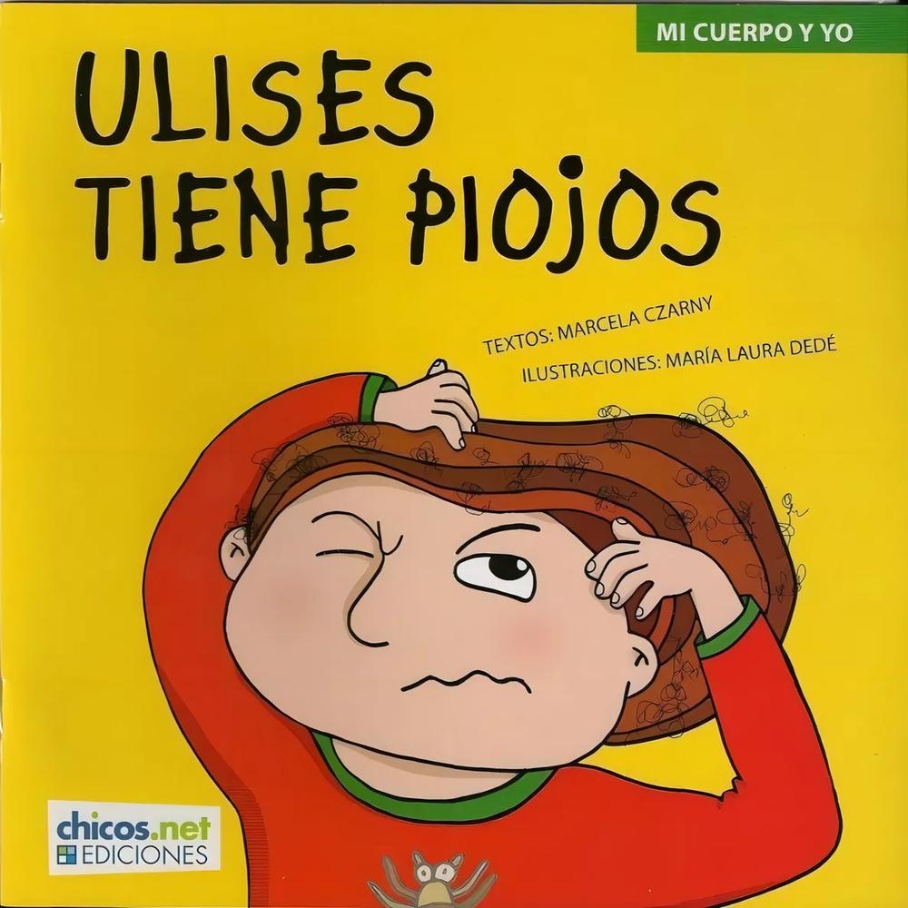 Foto 1 | Ulises Tiene Piojos