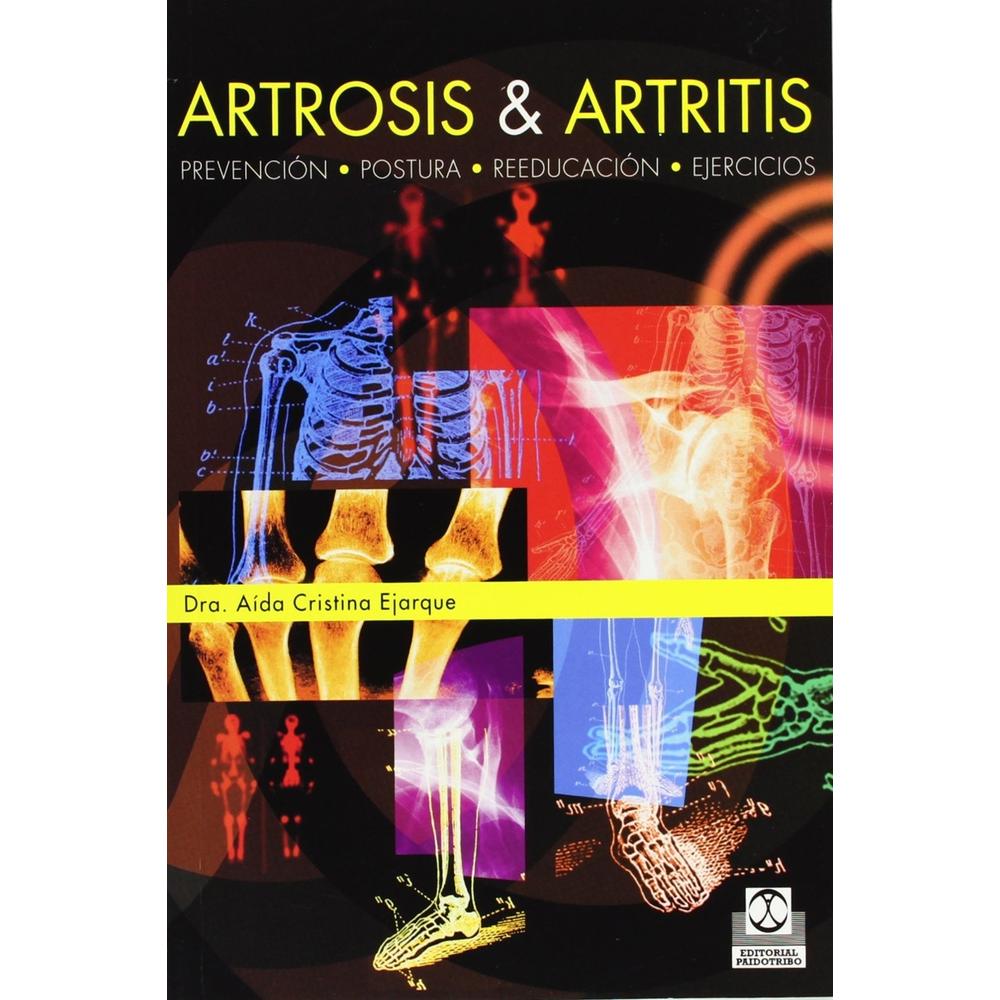 Artrosis Y Artritis