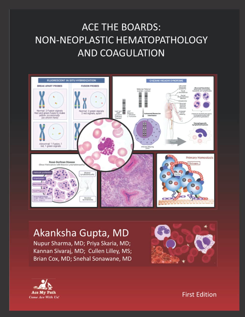Foto 2 pulgar | Ace The Boards: Non - Neoplastic Hematopathology And Coagulation (ace My Path) - Venta Internacional.