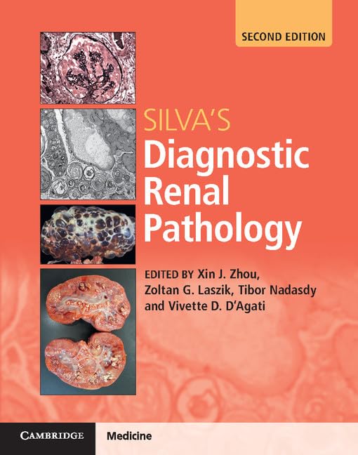 Foto 2 pulgar | Libro: Cambridge University Press: La Patología Renal Diagnóstica De Silva - Venta Internacional.