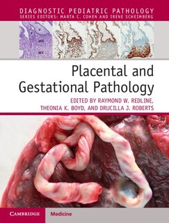 Foto 1 | Libro: Cambridge University Press: Patología Placentaria Y Gestacional - Venta Internacional.