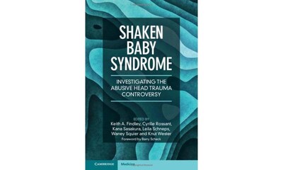 Foto 1 | Book Shaken Baby Syndrome: Investigando Un Traumatismo Craneal Abusivo - Venta Internacional.