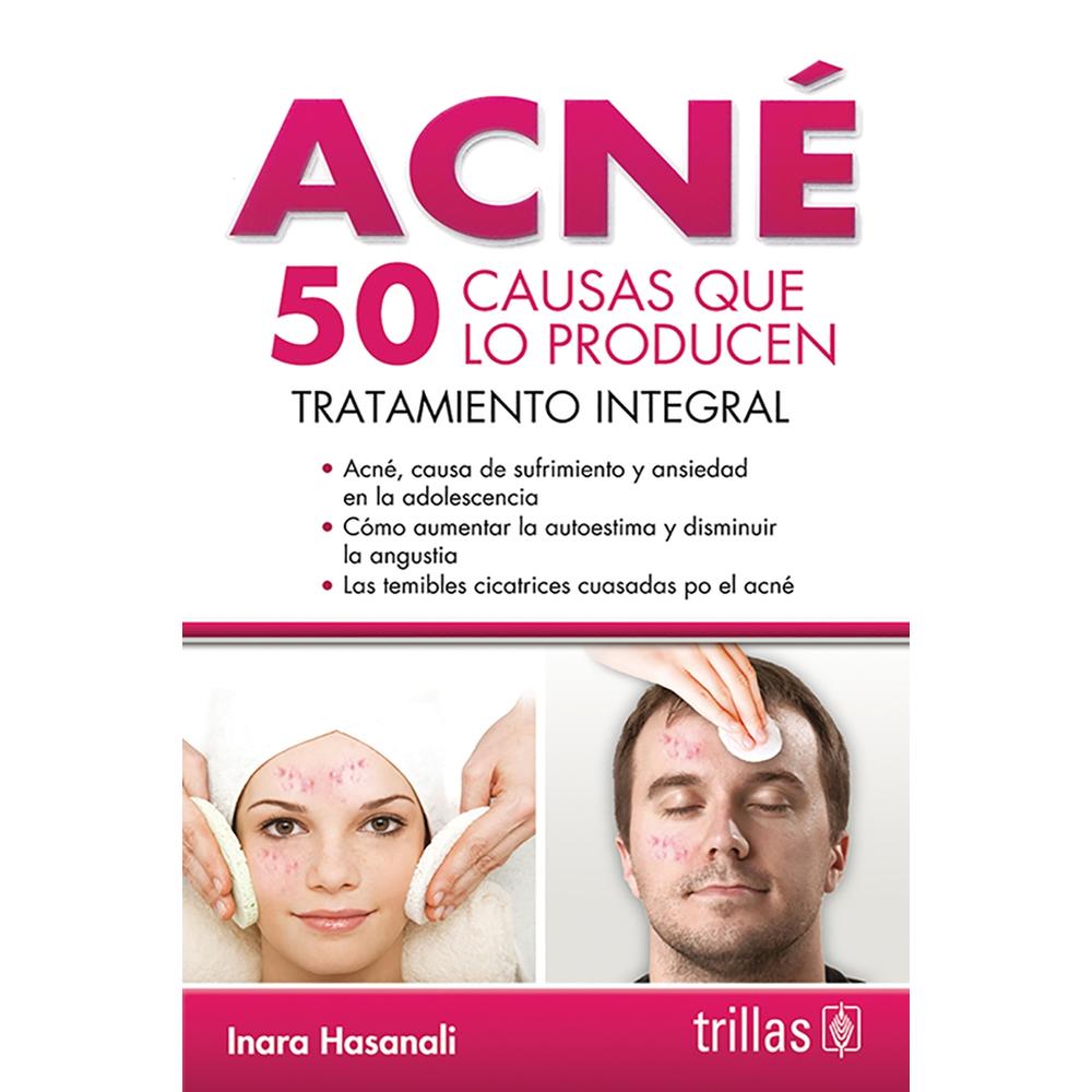 Foto 2 pulgar | Acné: 50 Causas Que Lo Producen
