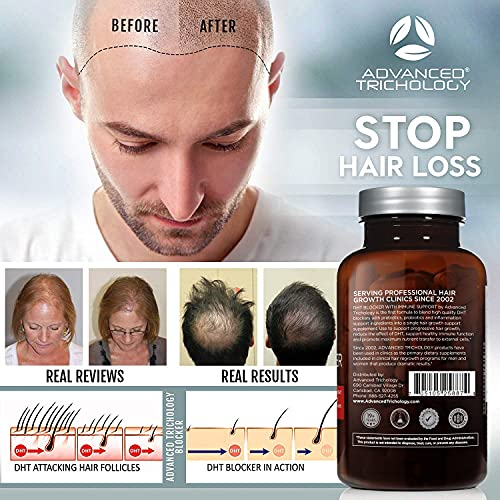 Foto 5 pulgar | Suplemento para el Crecimiento del Cabello Advanced Trichology Dht Blocker - Venta Internacional