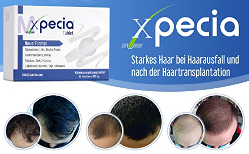 Foto 4 pulgar | Suplemento Xpecia Para Hombres Contra La Caída Del Cabello 60 Tabletas - Venta Internacional.