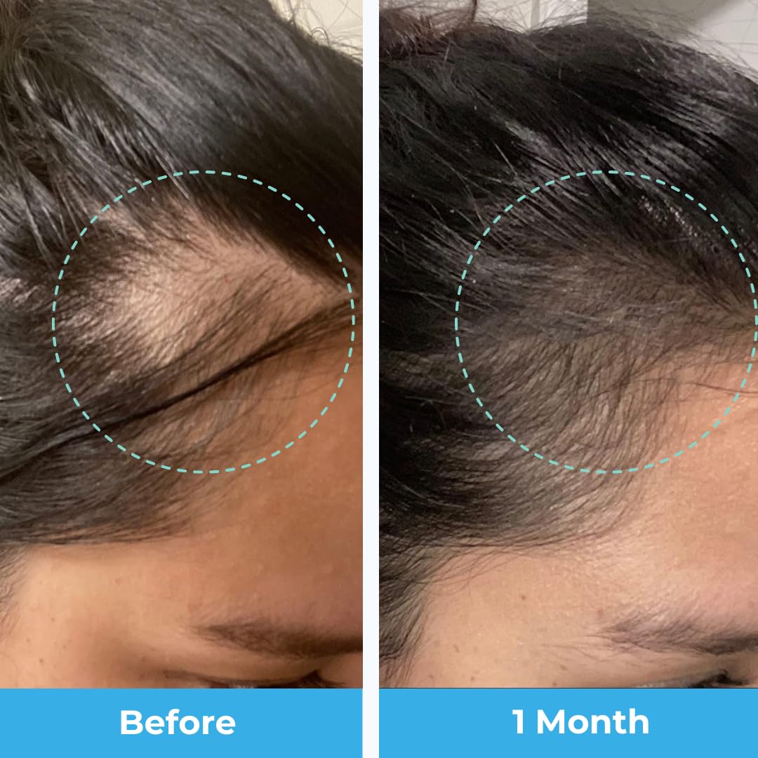 Foto 4 pulgar | Gomitas De Maracuyá Posparto Con Vitaminas Para La Pérdida Del Cabello Baby Blues - Venta Internacional.
