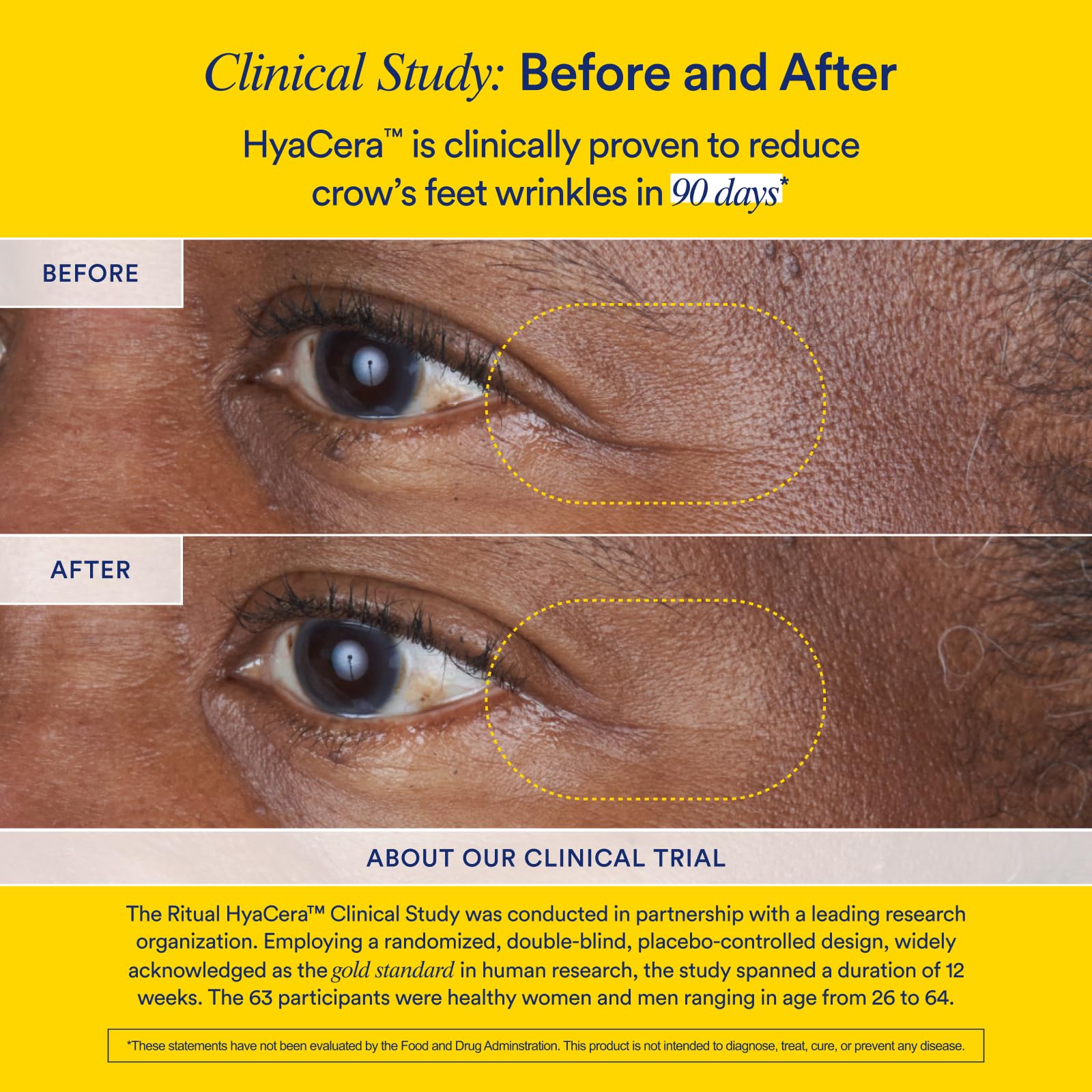 Foto 6 pulgar | Supplement Ritual Hyacera Skin Wrinkle Support, Suministro De 30 Días - Venta Internacional.