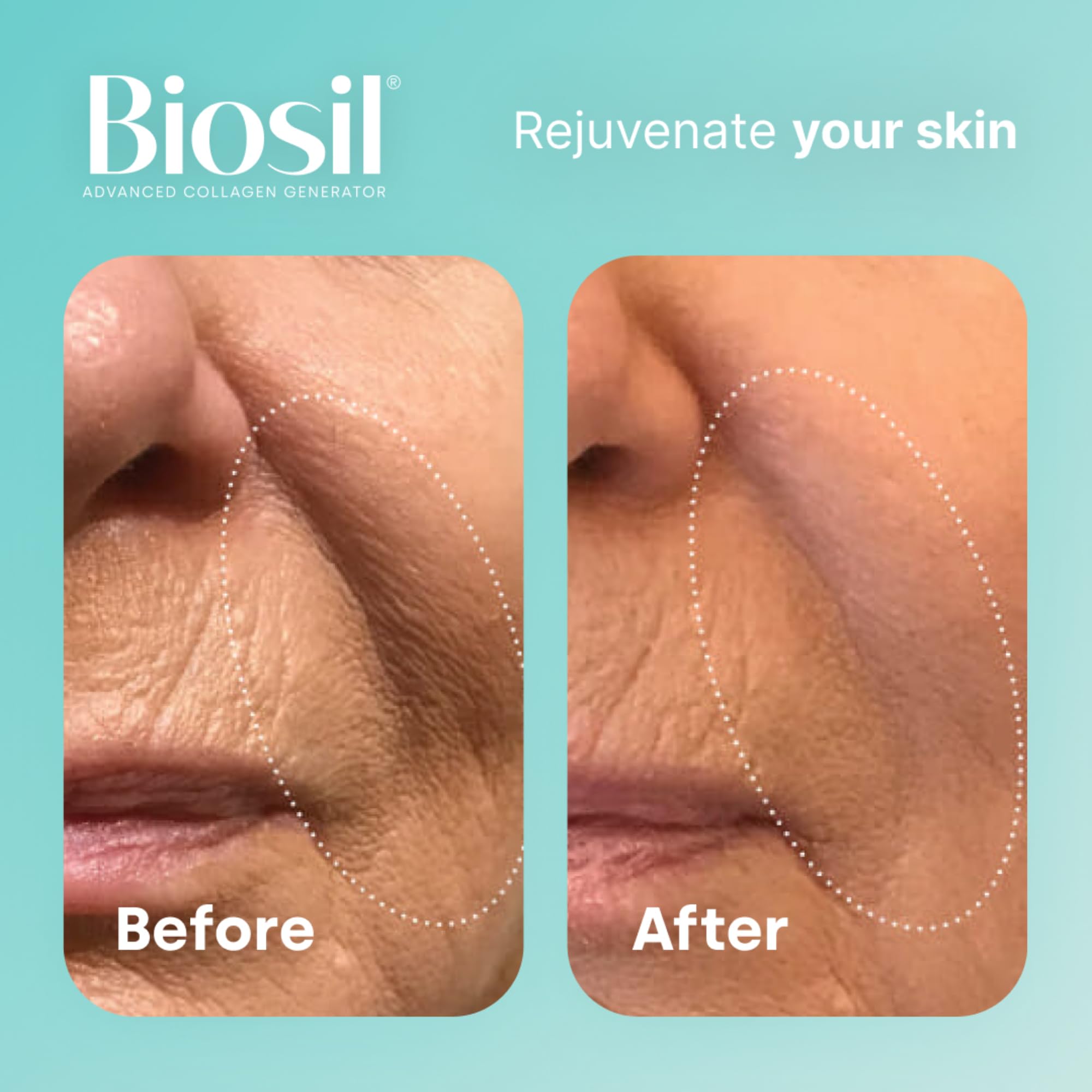 Foto 6 pulgar | Suplemento Biosil Collagen Generator 120 Cápsulas X2 120 Días - Venta Internacional.