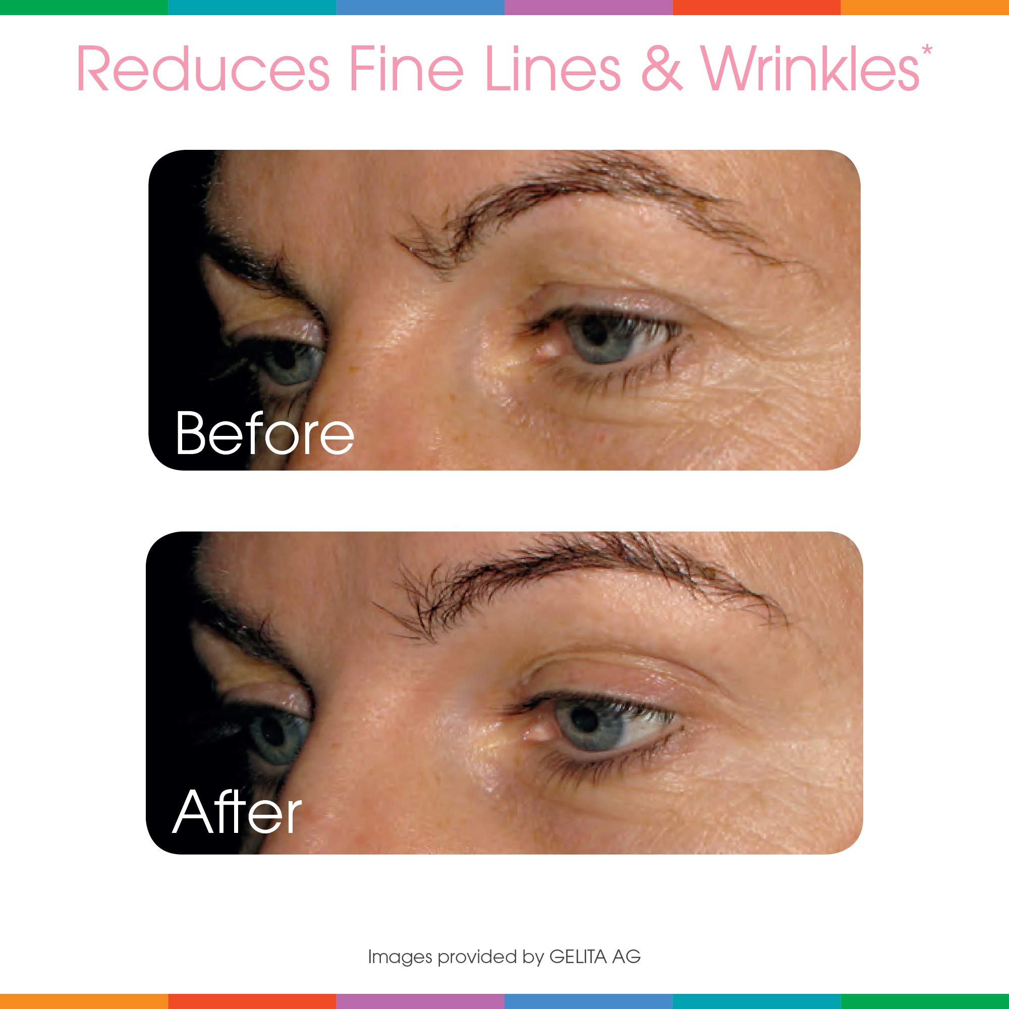 Foto 7 | Suplemento De Colágeno En Polvo Sparkle Wellness Skin Boost - Venta Internacional.