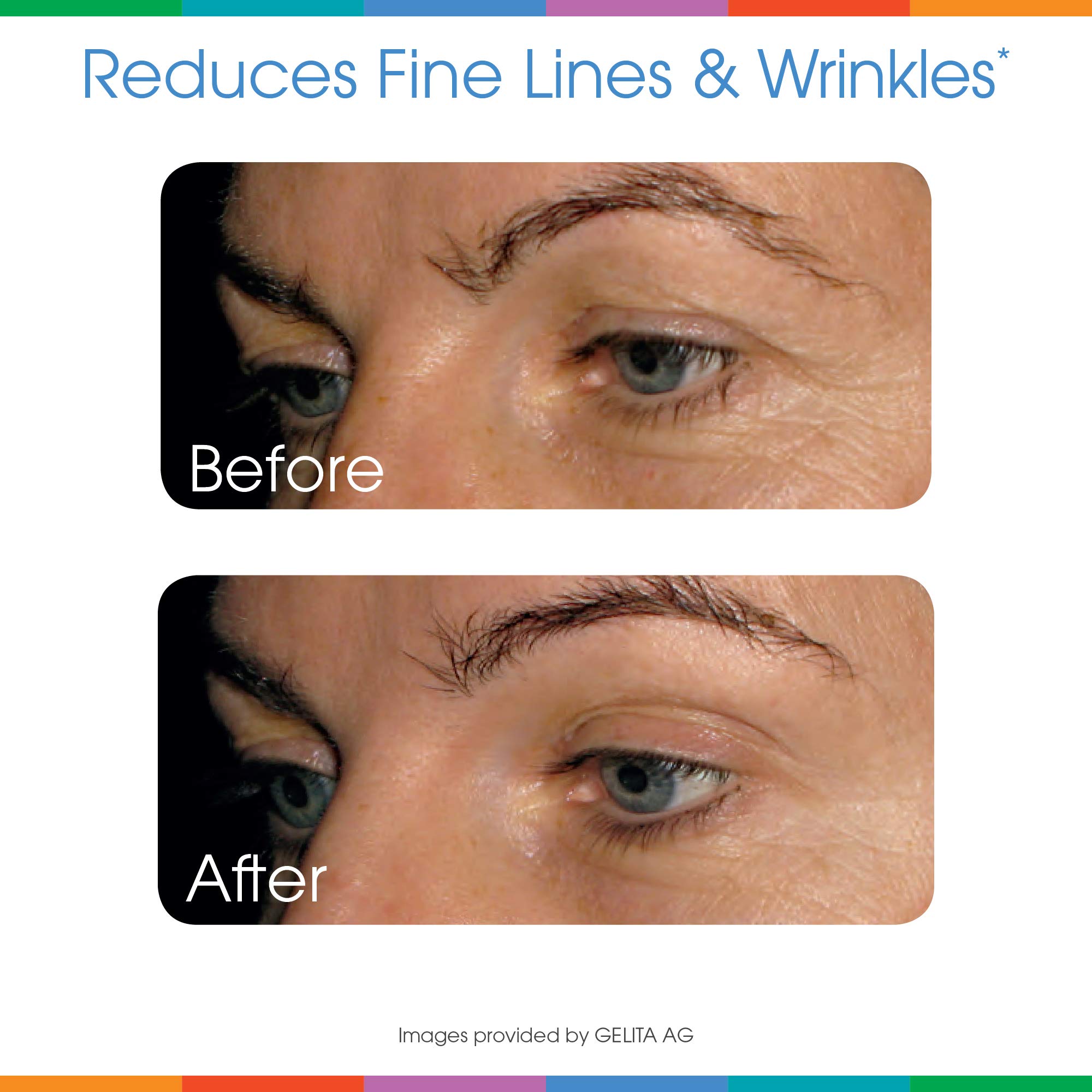 Foto 8 pulgar | Suplemento De Colágeno En Polvo Sparkle Wellness Skin Boost Plus - Venta Internacional.
