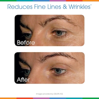 Foto 7 | Suplemento De Colágeno En Polvo Sparkle Wellness Skin Boost Plus - Venta Internacional.
