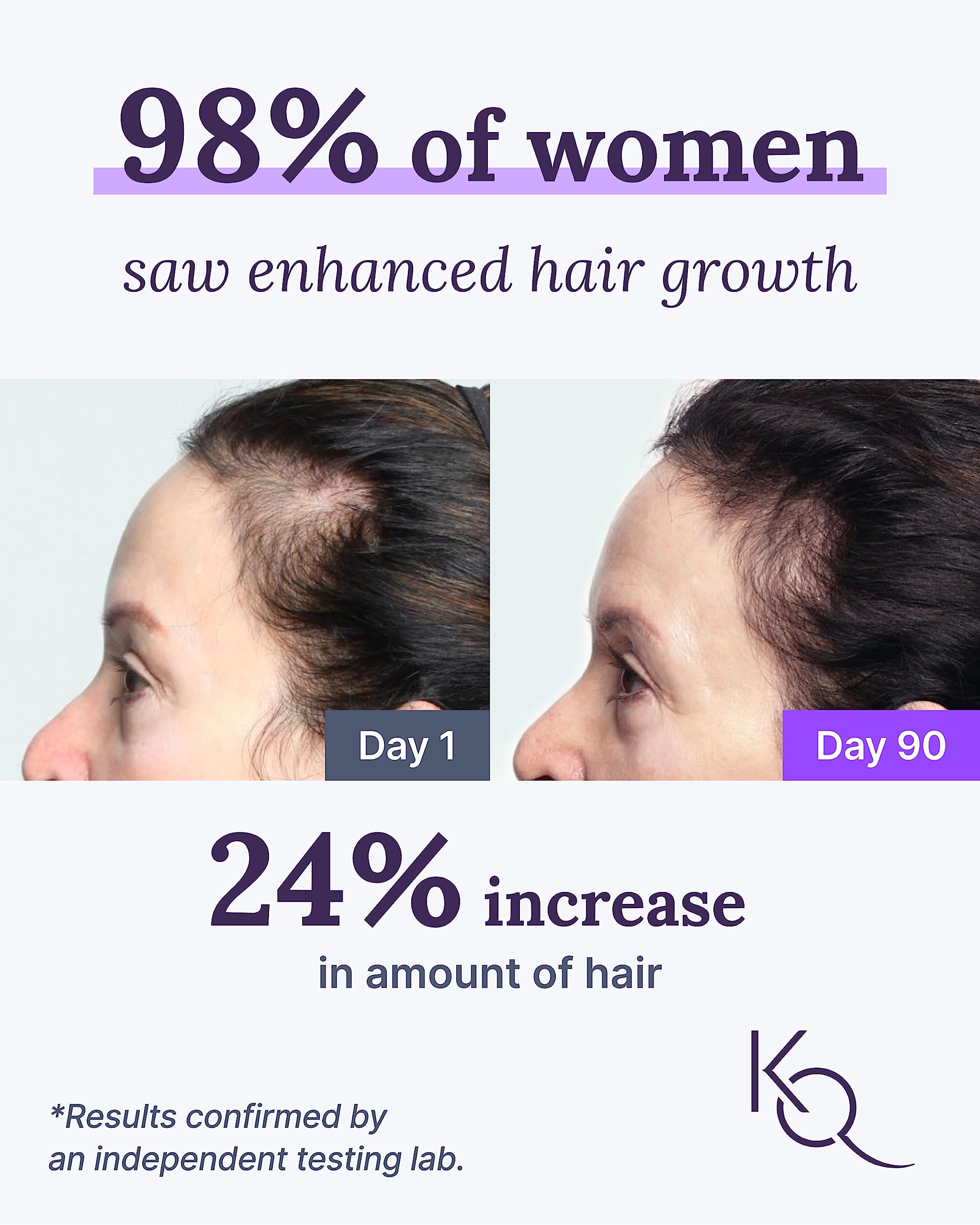Foto 2 | Suplemento Keranique Keraviatin Hair & Scalp Health 120 Soft - Venta Internacional.