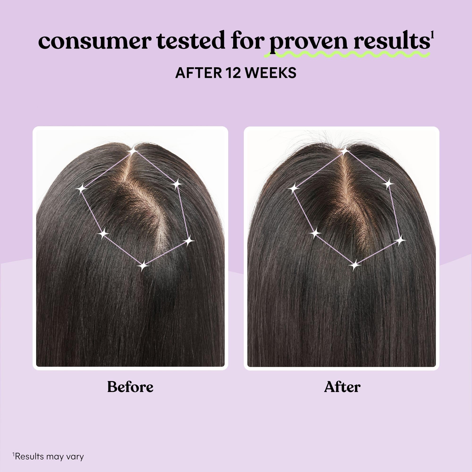 Foto 5 pulgar | Suplemento Para El Crecimiento Del Cabello Lemme Grow Para Mujeres, Suministro De 1 Mes - Venta Internacional.