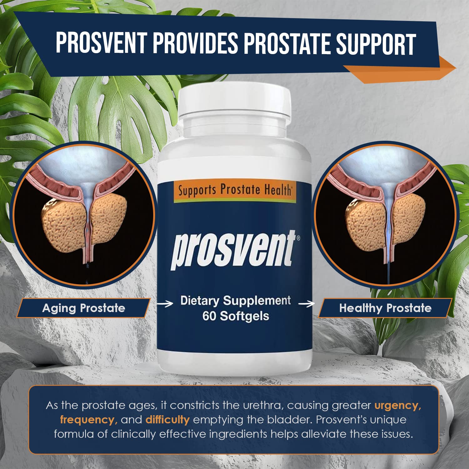 Foto 8 pulgar | Suplemento Prosvent Advanced Prostate Support Para Hombres, 60 Unidades - Venta Internacional.