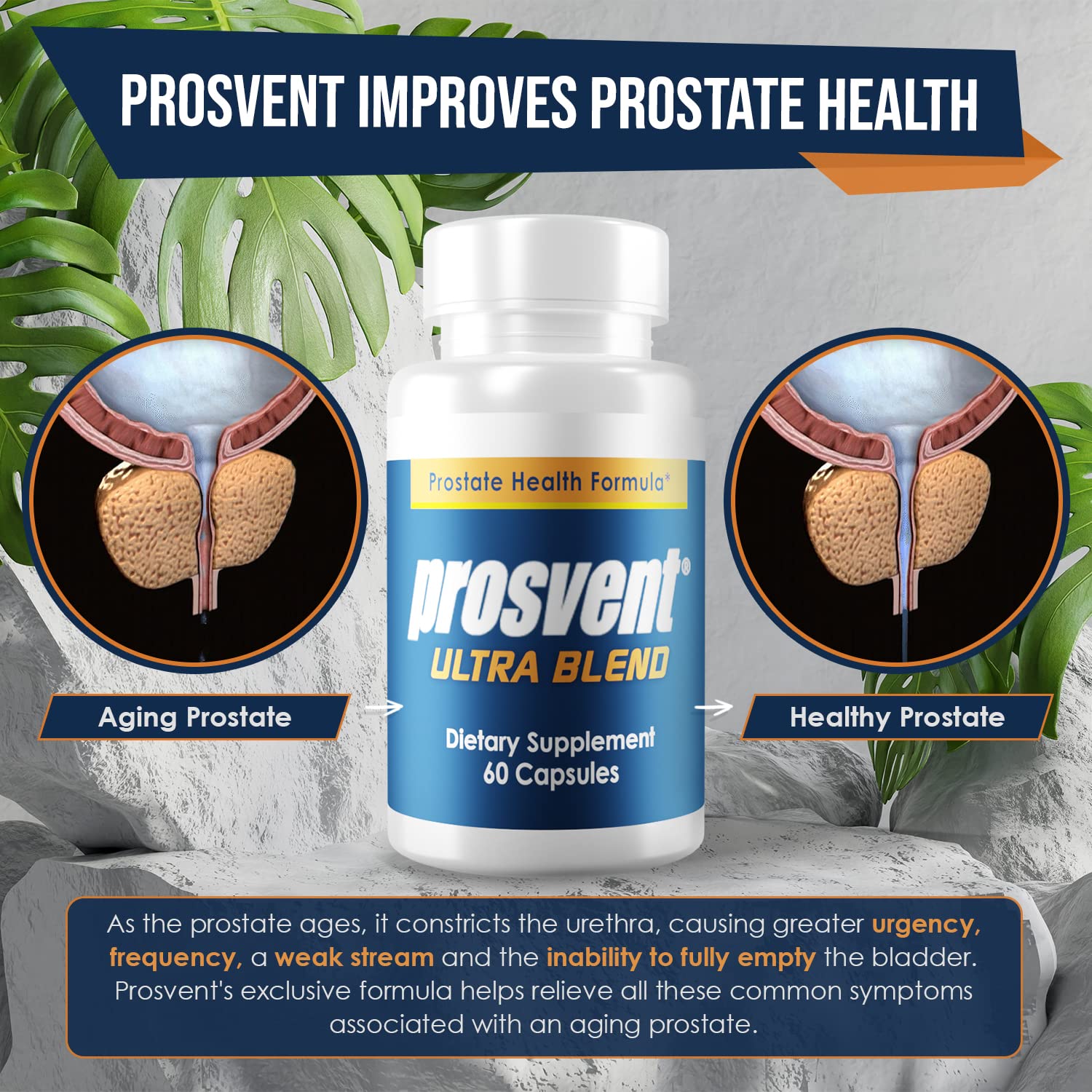 Foto 6 pulgar | Suplemento Prosvent Advanced Prostate Support Ultra De 60 Unidades - Venta Internacional.