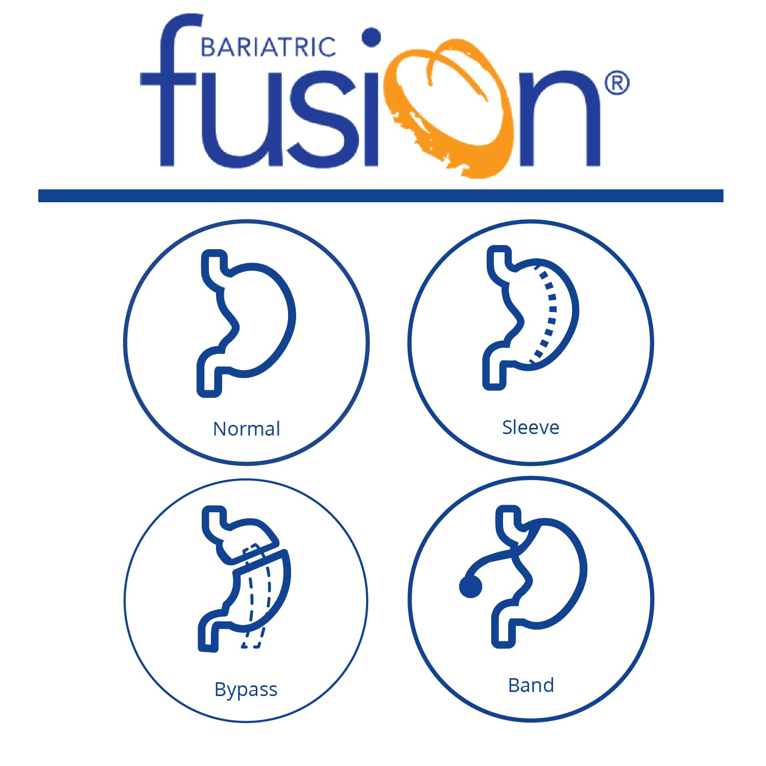 Foto 7 pulgar | Suplemento Bariatric Fusion Digestive Support 60 Cápsulas - Venta Internacional