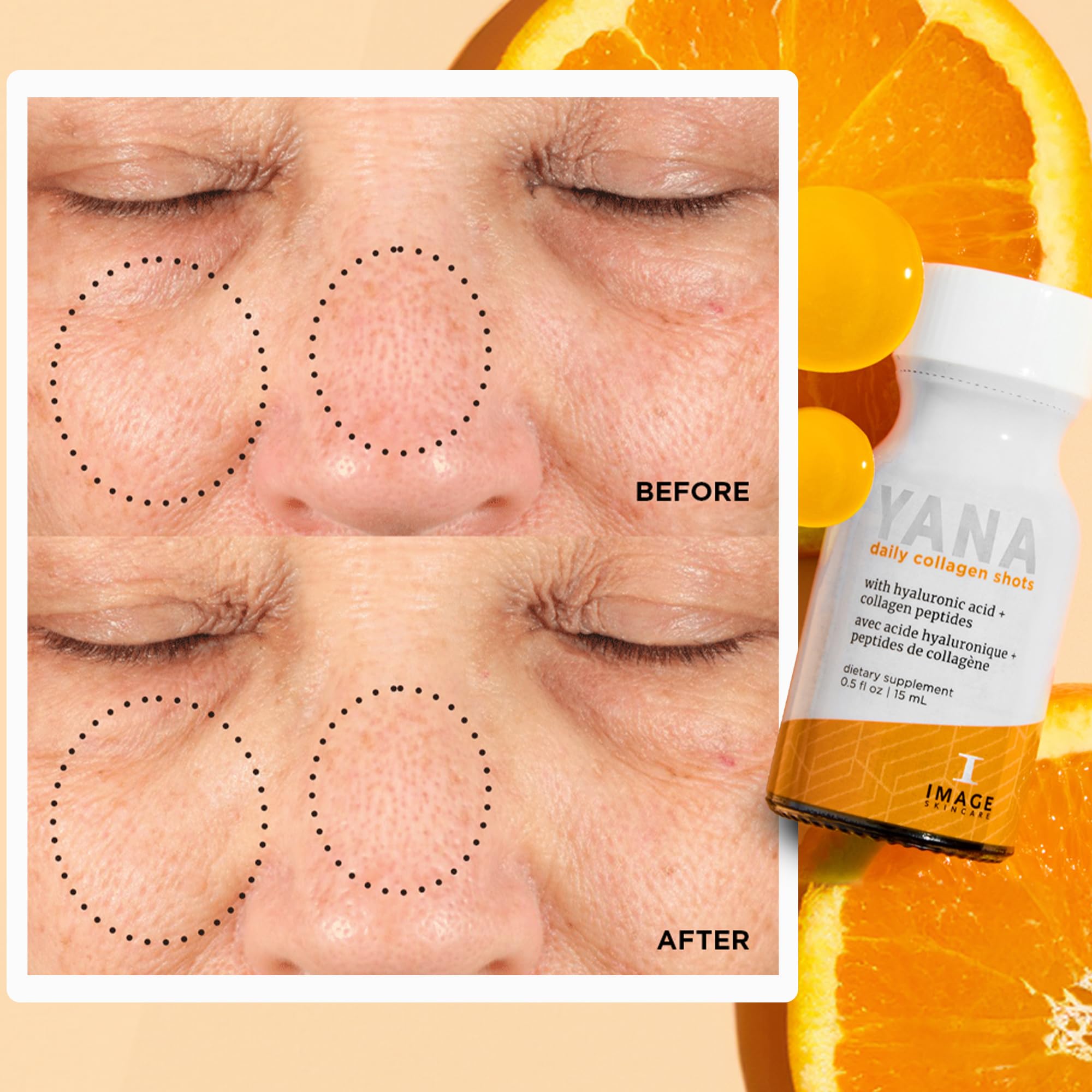 Foto 5 pulgar | Inyecciones Diarias de Colágeno Image Skincare 28 Frascos de 15 ml C/U - Venta Internacional