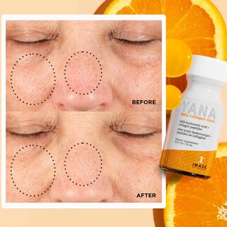 Foto 4 | Inyecciones Diarias de Colágeno Image Skincare 28 Frascos de 15 ml C/U - Venta Internacional