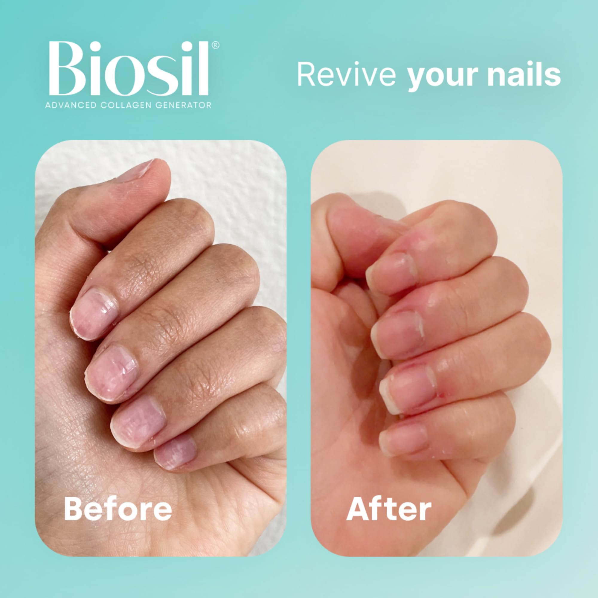 Foto 6 pulgar | Suplemento Biosil Collagen Generator 60 Cápsulas Líquidas - Venta Internacional.