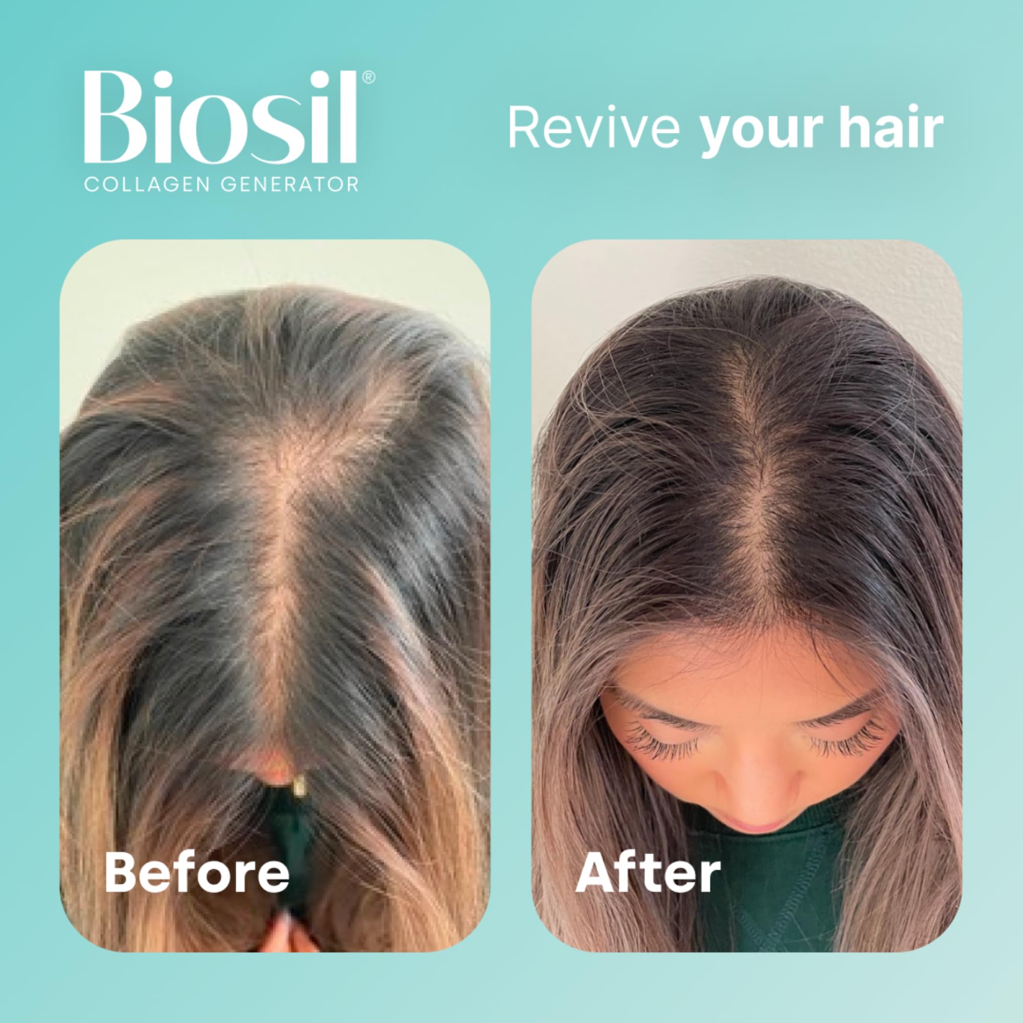 Foto 6 pulgar | Suplemento Biosil Collagen Generator 2 Piezas-Venta Internacional
