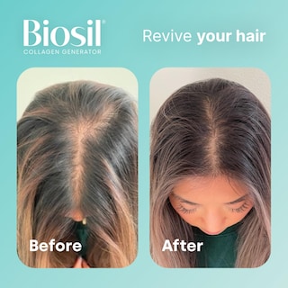 Foto 5 | Suplemento Biosil Collagen Generator 2 Piezas-Venta Internacional