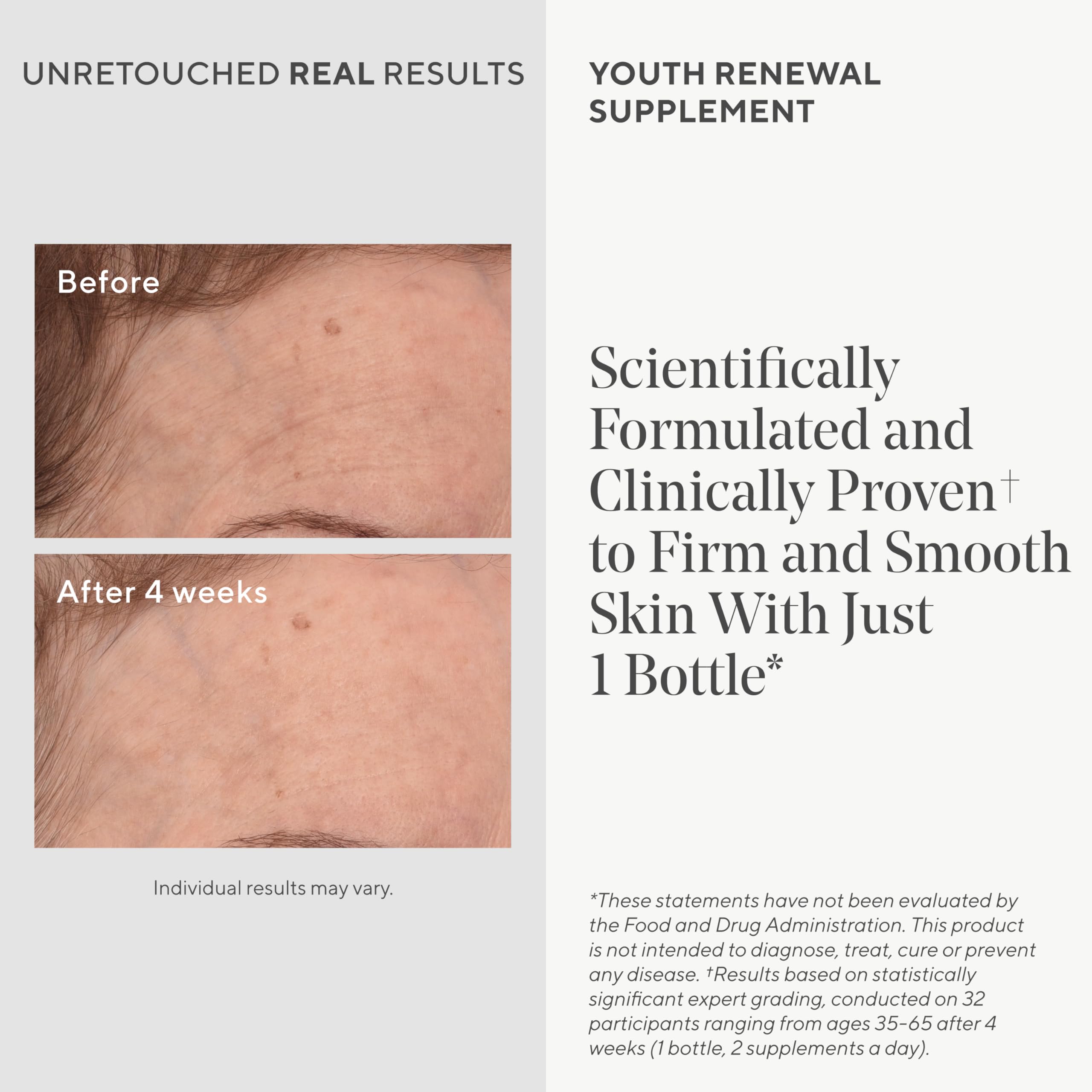 Foto 3 | Suplemento Murad Youth Renewal Para Una Piel Suave Y Tersa 28 Cápsulas - Venta Internacional