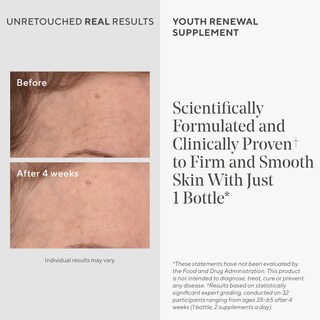 Foto 3 | Suplemento Murad Youth Renewal Para Una Piel Suave Y Tersa 28 Cápsulas - Venta Internacional