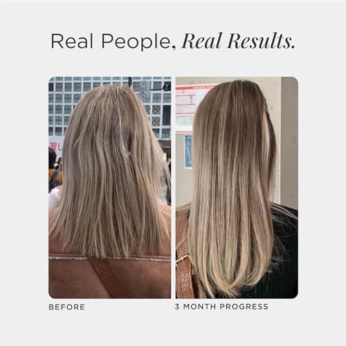 Foto 4 pulgar | Suplemento Para El Crecimiento Del Cabello Jshealth Hair Formula 60 Cápsulas - Venta Internacional.