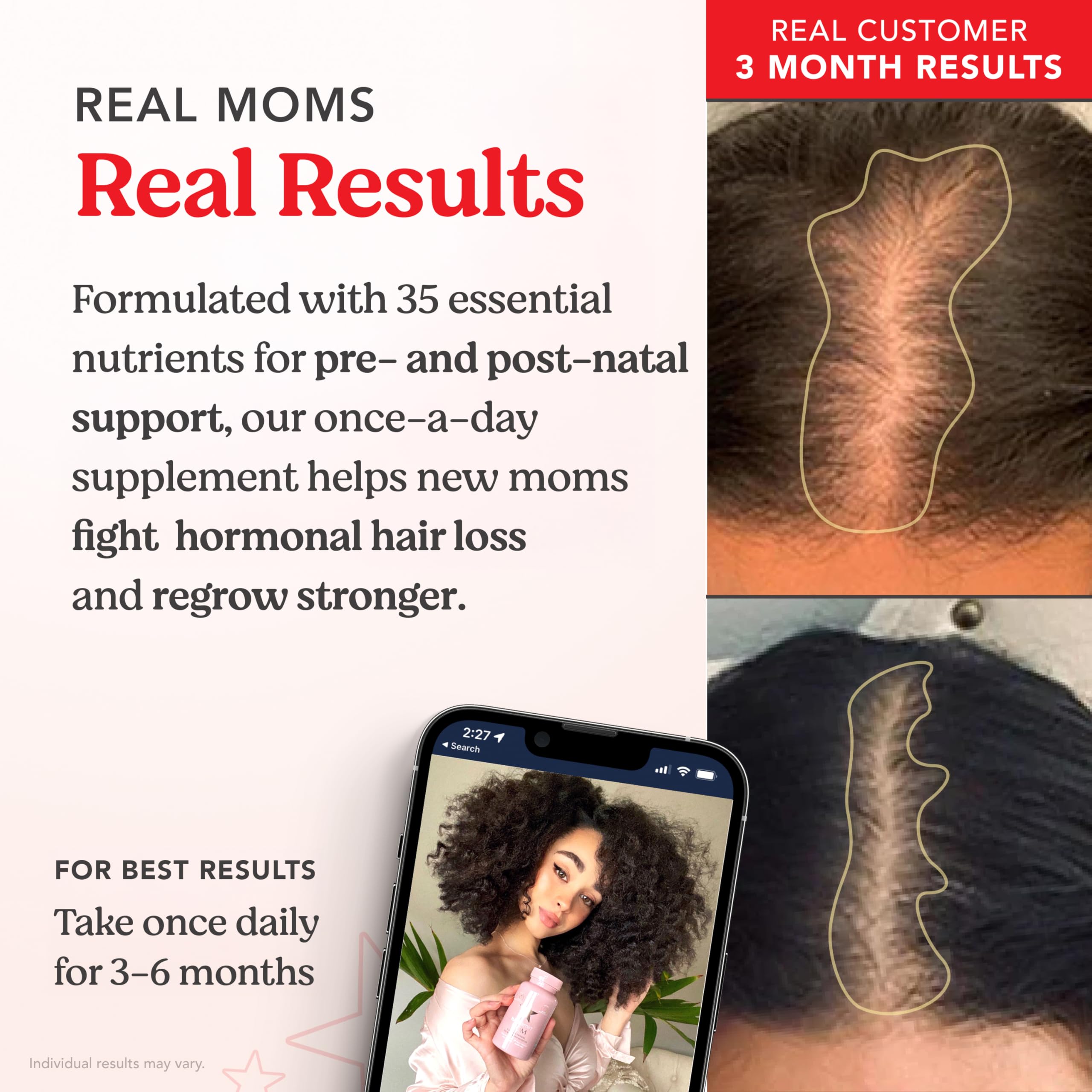 Foto 5 pulgar | Suplemento Hairtamin Mom, Vegano, Prenatal Y Posnatal, 90 Cápsulas - Venta Internacional.
