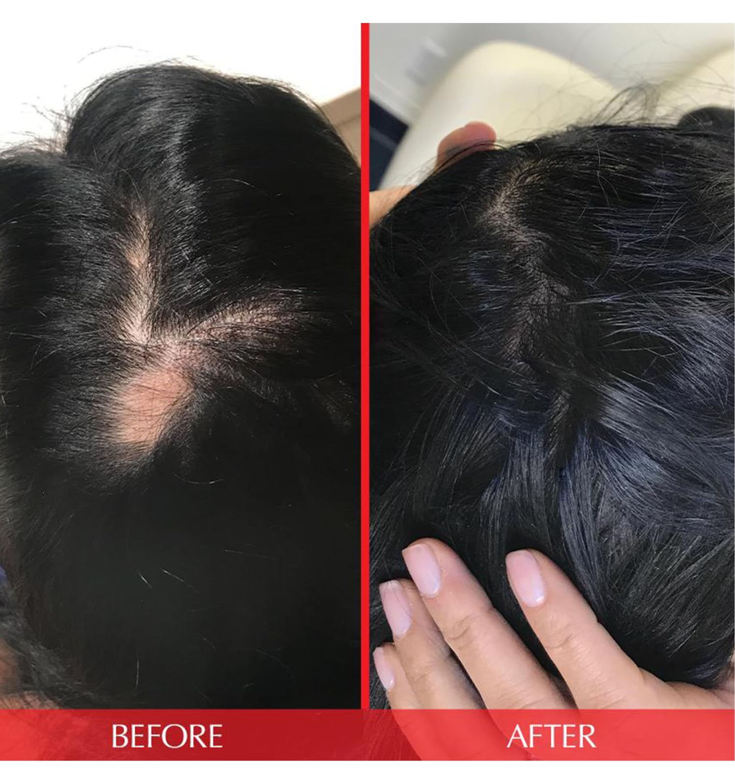 Foto 6 pulgar | Vitaminas Para El Cabello Hairtamin Advanced Formula 30 Cápsulas - Venta Internacional.