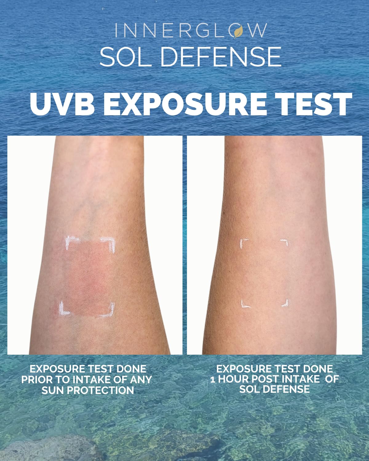Foto 3 | Suplemento Inner Glow Sol Defense Gummies Skin Resilience - Venta Internacional.