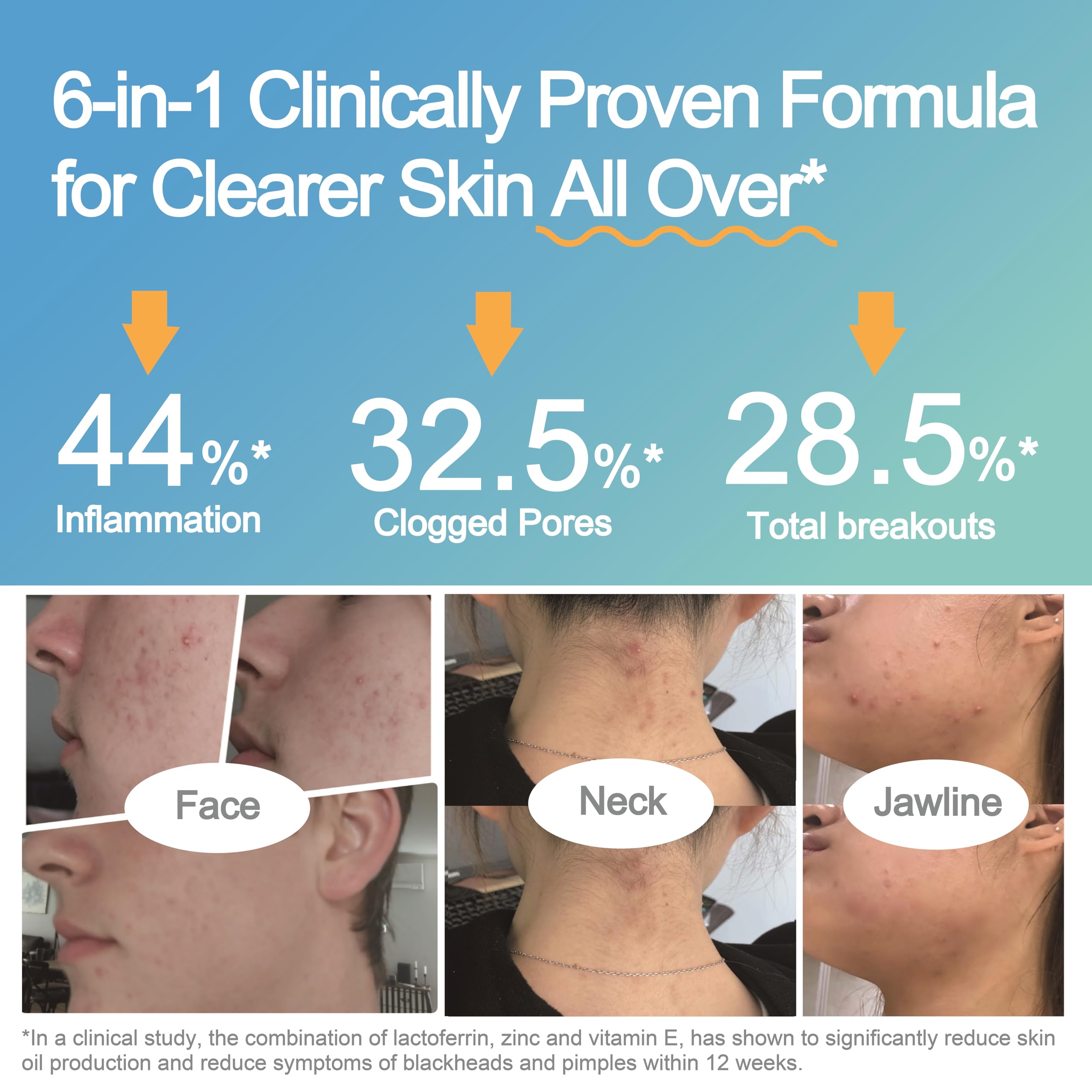Foto 2 | Suplemento Probiótico Lifespace Acne Relief + Skin Rebalance - Venta Internacional.