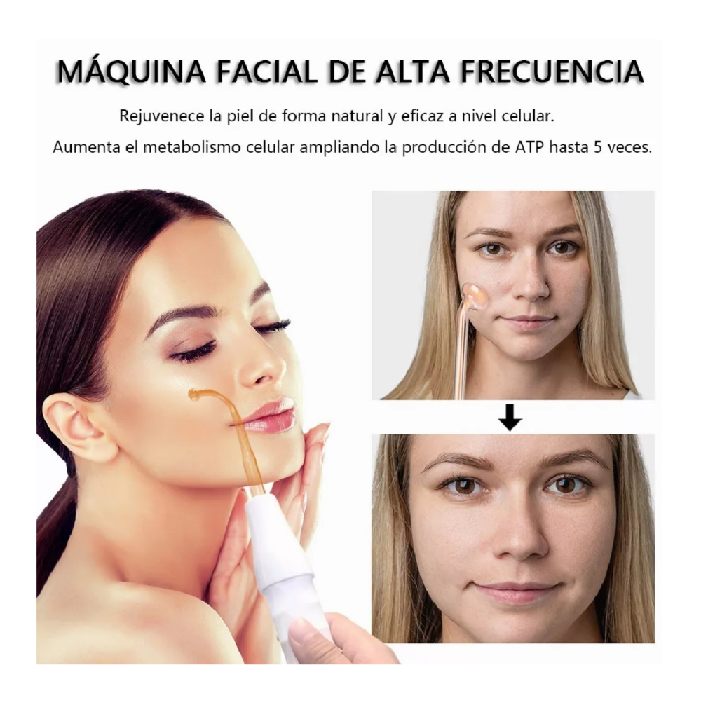 Foto 4 pulgar | Máquina De Terapia De Alta Frecuencia Para La Piel Belug Blanco