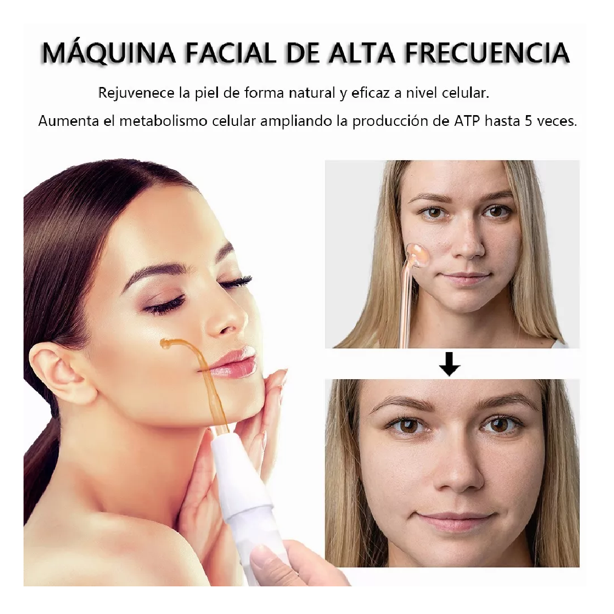 Foto 4 pulgar | Máquina De Terapia De Alta Frecuencia Para La Piel Blanco