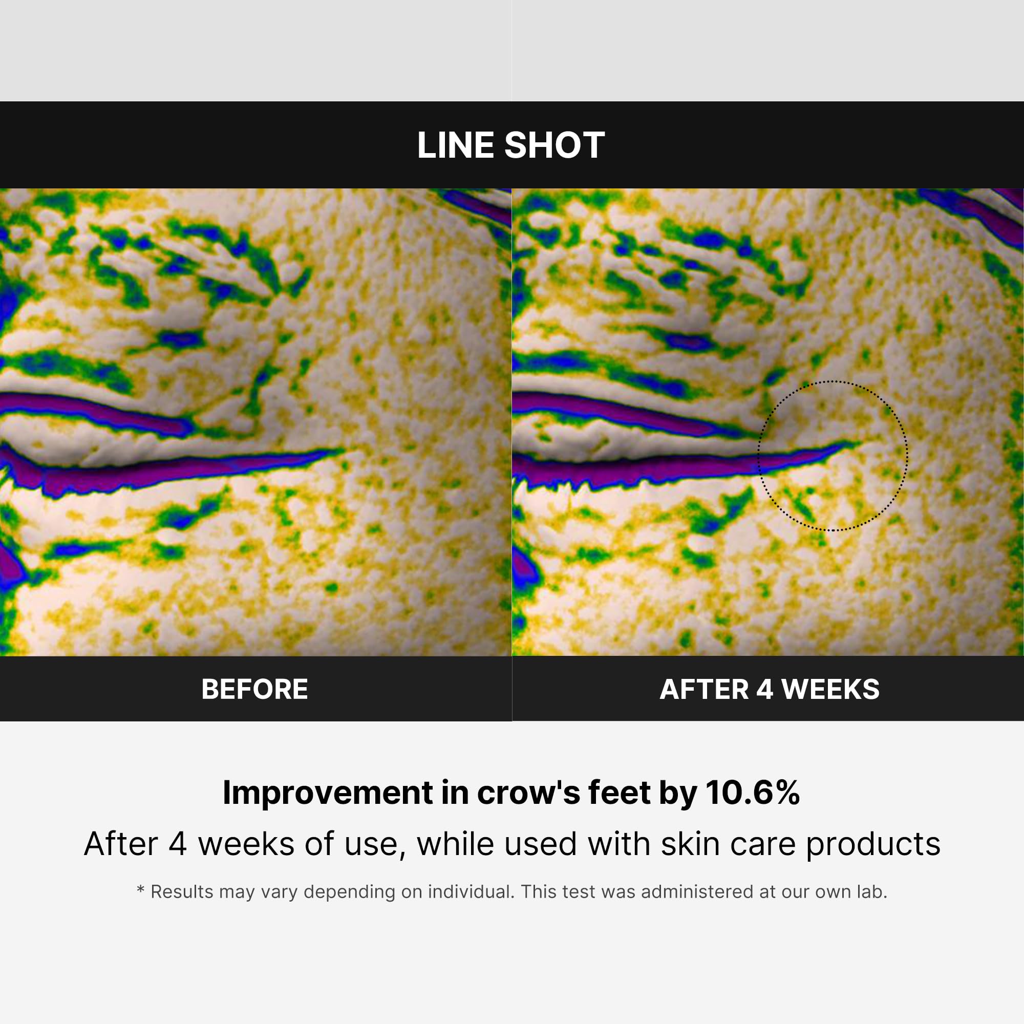 Foto 4 | Dispositivo Para El Cuidado De La Piel Medicube Age-r Line Shot Anti-aging - Venta Internacional.