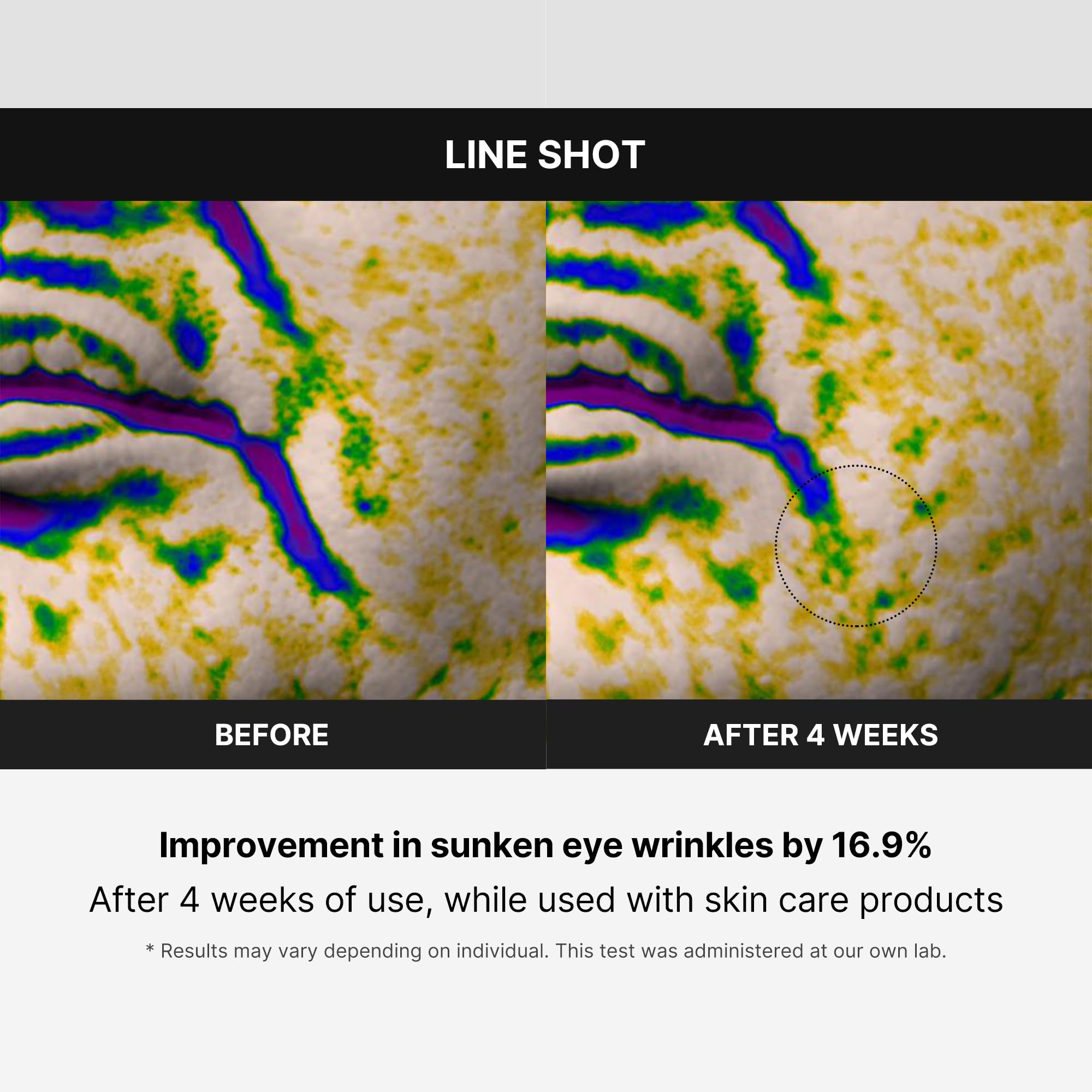 Foto 5 | Dispositivo Para El Cuidado De La Piel Medicube Age-r Line Shot Anti-aging - Venta Internacional.