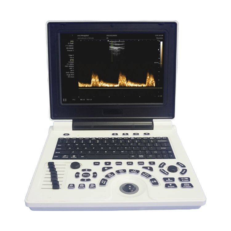 Foto 1 | Ecografo Clinicparts Máquina de Escáner de Ultrasonido