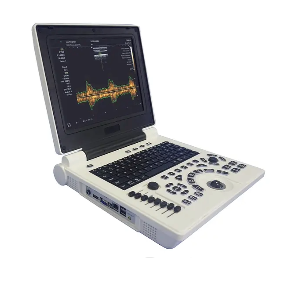 Foto 4 pulgar | Ecografo Clinicparts Máquina de Escáner de Ultrasonido