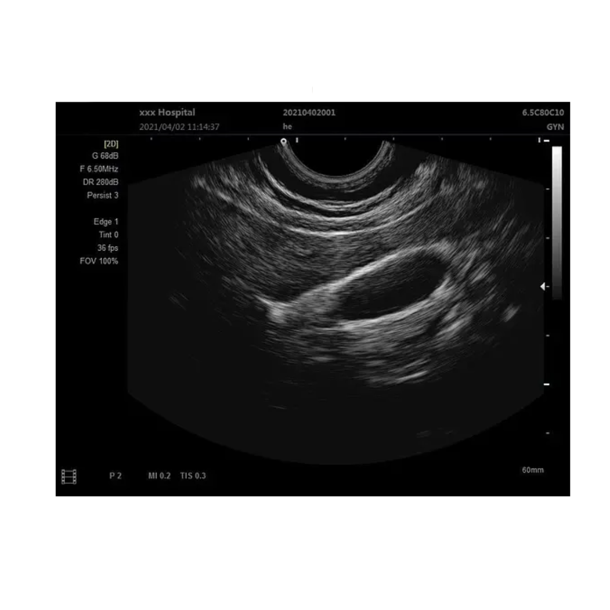 Foto 5 pulgar | Ecografo Clinicparts Máquina de Escáner de Ultrasonido
