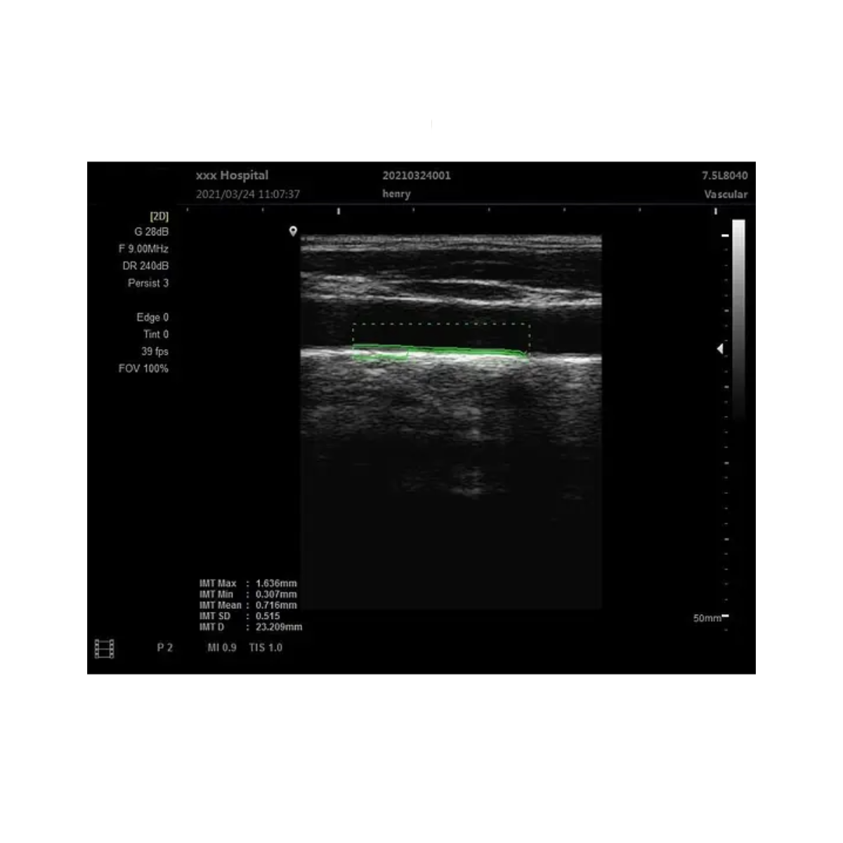 Foto 6 pulgar | Ecografo Clinicparts Máquina de Escáner de Ultrasonido