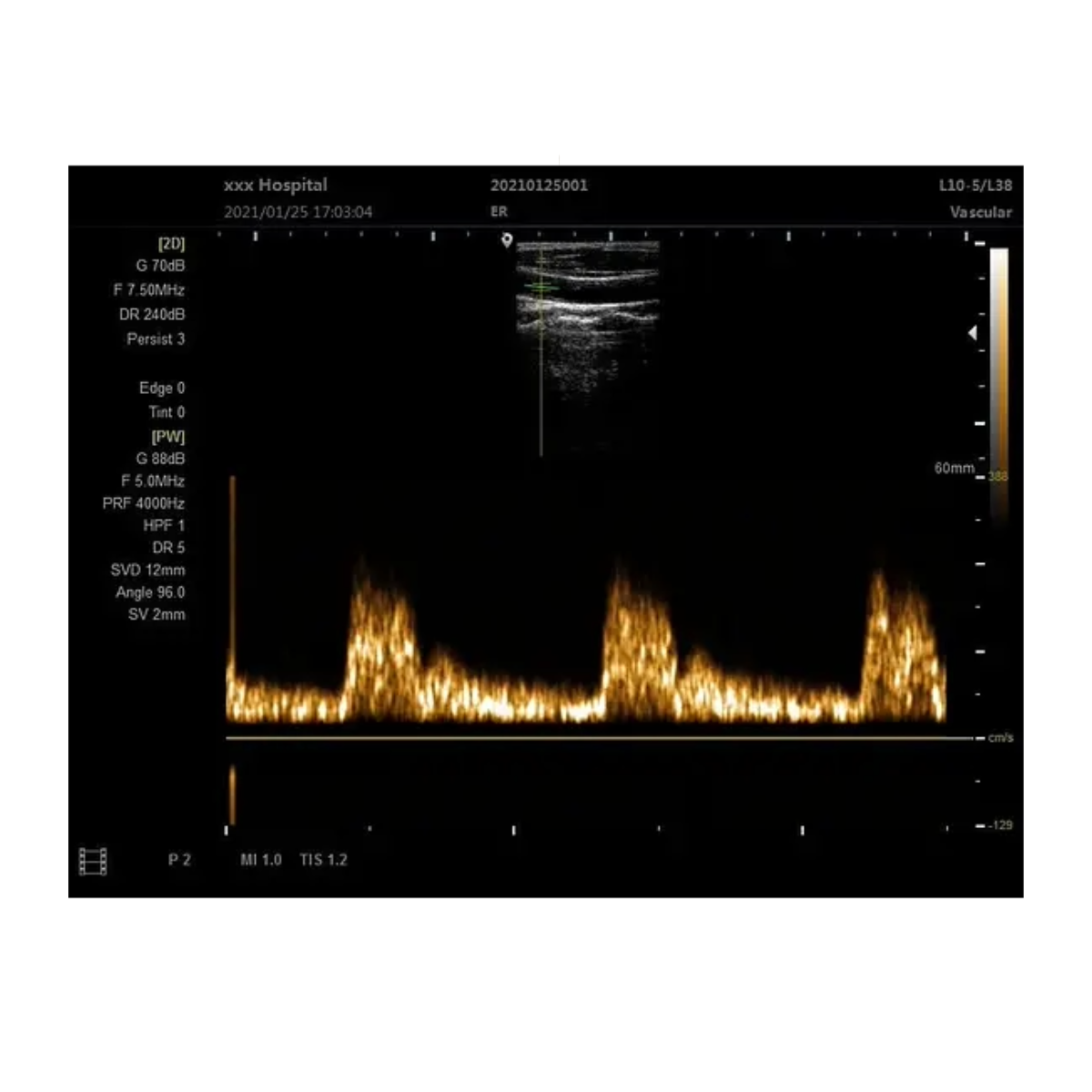 Foto 7 pulgar | Ecografo Clinicparts Máquina de Escáner de Ultrasonido