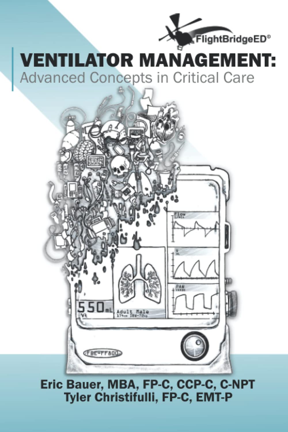 Foto 2 pulgar | Ventilator Management: Advanced Concepts In Critical Care - Venta Internacional.