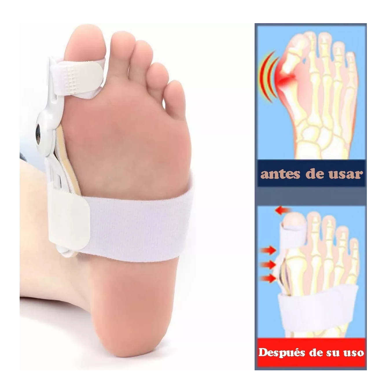 Foto 4 pulgar | Corrector Ortopédico de Juanetes Belug 2 Piezas