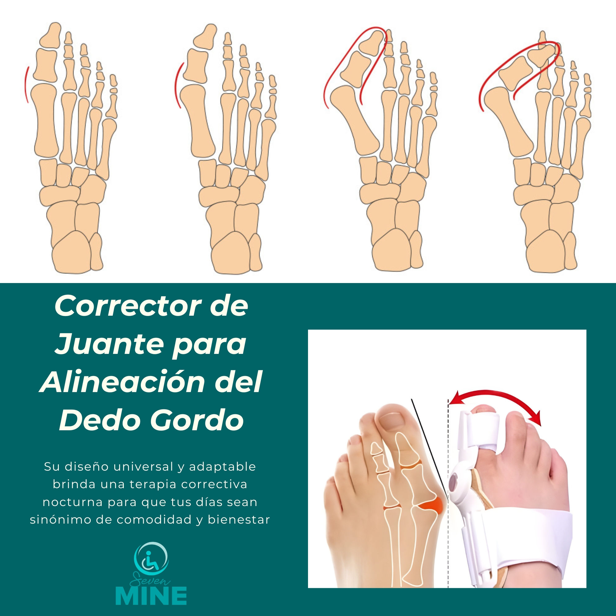 Foto 3 | Corrector De Juanetes Férula Universal - Ajuste Para Ambos Pies, Diseño Anatómico Para Uso Diario Y Nocturno, A