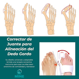 Foto 3 | Corrector De Juanetes Férula Universal - Ajuste Para Ambos Pies, Diseño Anatómico Para Uso Diario Y Nocturno, A