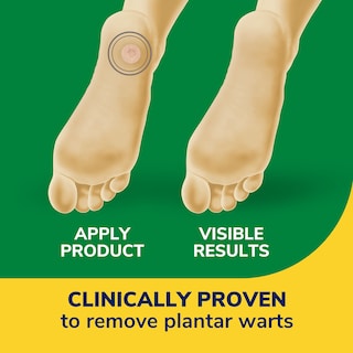 Foto 3 | Eliminador De Verrugas Dr. Scholl's Clear Away Plantar 24 Tratamientos - Venta Internacional.