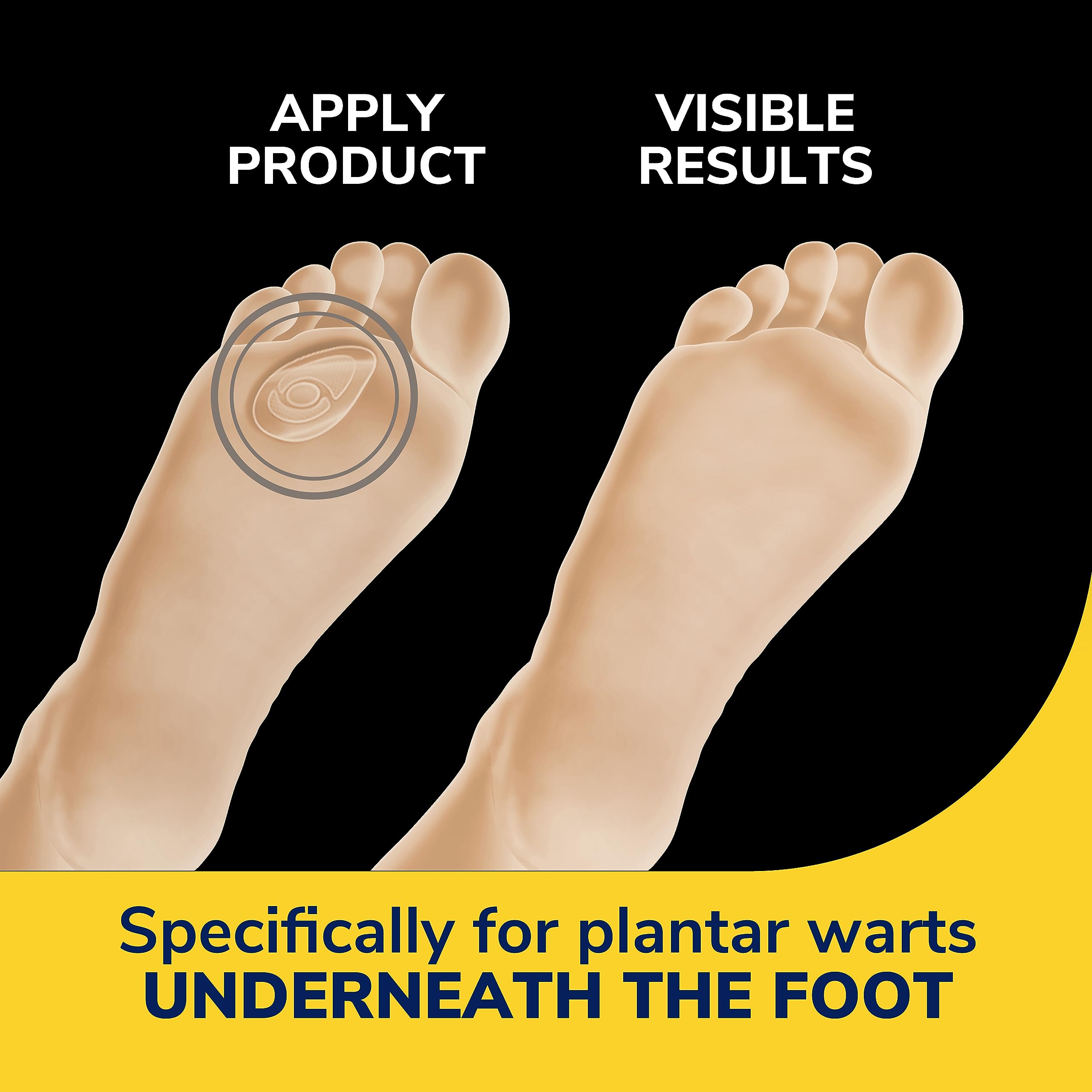 Foto 2 | Plantilla Dr. Scholl's  Eliminador de  Verrugas - Venta Internacional