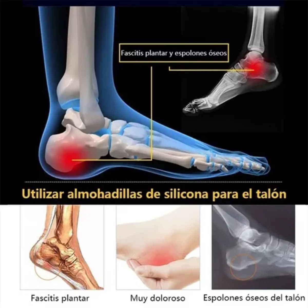 Foto 8 pulgar | Plantillas Ortopédica Taloneras Espolón Calcáneo 1 Par